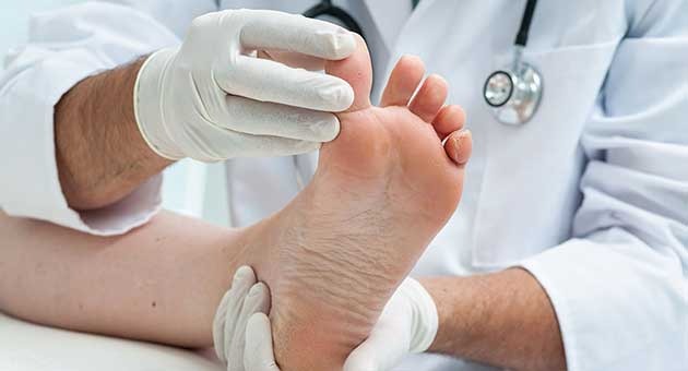 Ayak Mantarının Belirtileri nelerdir?